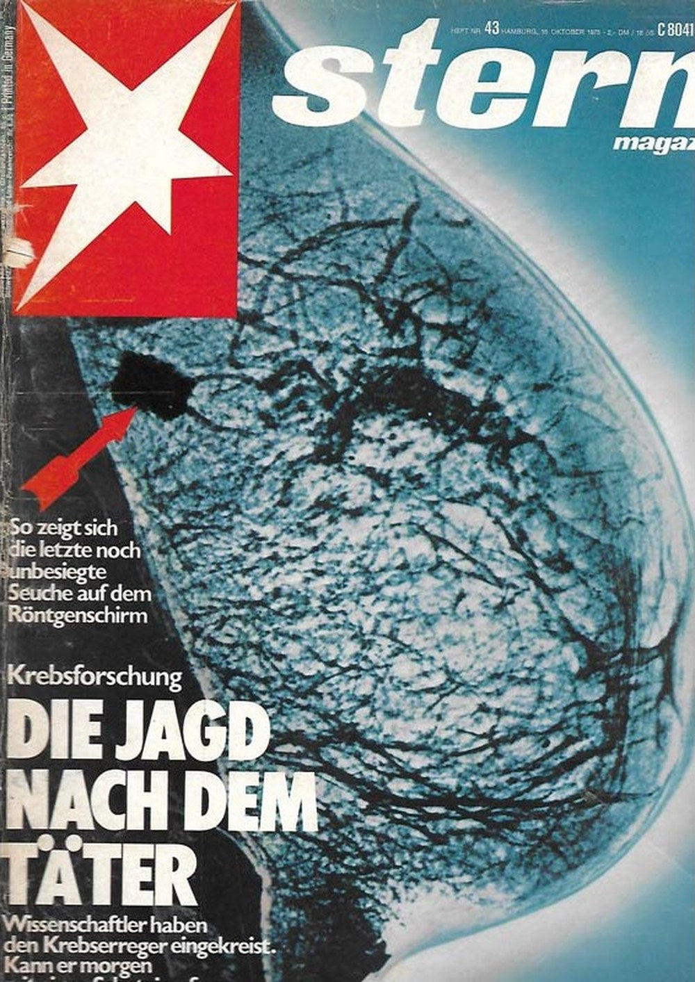 Stern Magazin Deutschland 1975-43 Krebsforschung Medizin Wissenschaft
